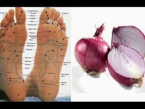 putting onions in you socks